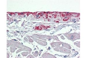 POSTN antibody was used for immunohistochemistry at a concentration of 4-8 ug/ml. (Periostin 抗体  (N-Term))
