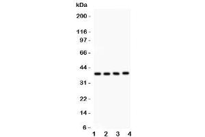 Western blot testing of IkB beta antibody and Lane 1:  mouse kidney (NFKBIB 抗体  (AA 56-237))