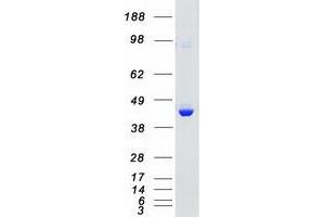 Western Blotting (WB) image for Mitogen-Activated Protein Kinase 11 (MAPK11) protein (Myc-DYKDDDDK Tag) (ABIN2725279)