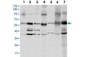 Western blot analysis of SRC monoclonal antobody, clone 1F11  against MCF-7 (1), A-431 (2), HeLa (3), HEK293 (4), NIH/3T3 (5), PC-12 (6) and COS-7 (7) cell lysate. (Src 抗体)