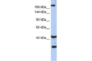 WB Suggested Anti-DISP1 Antibody Titration:  0. (DISP1 抗体  (Middle Region))