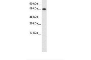 Image no. 1 for anti-Zinc Finger and BTB Domain Containing 45 (ZBTB45) (AA 253-302) antibody (ABIN6735949) (ZBTB45 抗体  (AA 253-302))