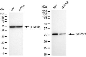 Western blotting analysis using GTF2F2 antibody (ABIN7798708).