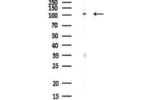 anti-Iron-Responsive Element Binding Protein 2 (IREB2) antibody