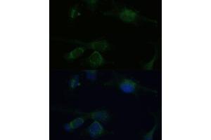 Immunofluorescence (IF) image for anti-Von Hippel-Lindau Tumor Suppressor, E3 Ubiquitin Protein Ligase (VHL) (AA 1-172) antibody (ABIN3020968)