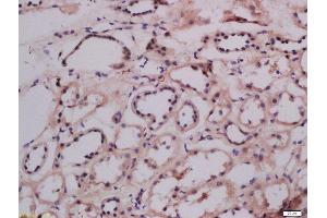 Formalin-fixed and paraffin embedded human kidney labeled with Anti-LMAN1 Polyclonal Antibody Polyclonal Antibody, Unconjugated  at 1:300 followed by conjugation to the secondary antibody and DAB staining. (LMAN1 抗体  (AA 31-130))
