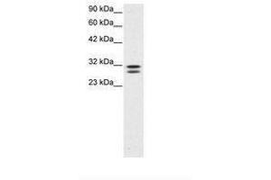 Image no. 3 for anti-HIV-1 Tat Interactive Protein 2, 30kDa (HTATIP2) (AA 30-79) antibody (ABIN202114) (HIV-1 Tat Interactive Protein 2, 30kDa (HTATIP2) (AA 30-79) 抗体)