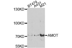 Western blot analysis of extracts of various cell lines, using AMOT antibody. (Angiomotin 抗体  (AA 1-300))