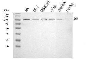 Western blot analysis of LOXL2 using anti-LOXL2 antibody (ABIN3043464).