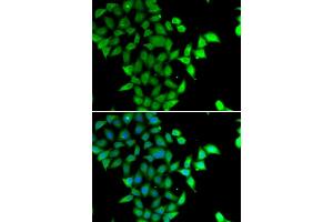 Immunofluorescence analysis of U2OS cells using STAM2 antibody. (STAM2 抗体)