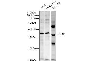 Western blot analysis of extracts of various cell lines, using KLF2 antibody (ABIN7268155) at 1:2720 dilution. (KLF2 抗体  (AA 50-150))