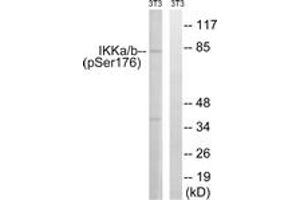 Western blot analysis of extracts from NIH-3T3 cells treated with TNF 20ng/ml 30', using IKK-alpha (Phospho-Ser176) /IKK-beta (Phospho-Ser177) Antibody. (IKK alpha 抗体  (pSer176))