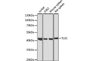 Western blot analysis of extracts of various cell lines, using TLX1 antibody. (TLX1 抗体)