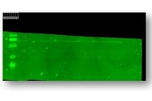 Western blot analysis of TRPC5 using anti-TRPC5 antibody (ABIN3043493).