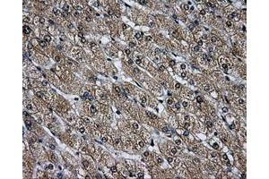 Immunohistochemical staining of paraffin-embedded Ovary tissue using anti-LOXmouse monoclonal antibody. (LOX 抗体  (AA 22-168))