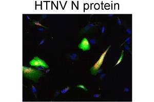 anti-Puumala Hantavirus (PUUV) antibody