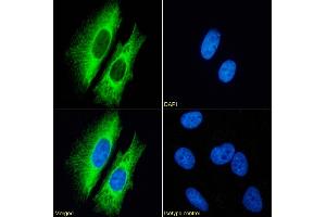 Immunofluorescence staining of fixed HeLa cells with anti-Cytokeratin 7 antibody OV-TL 12/30. (Recombinant Cytokeratin 7 抗体)