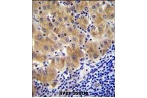 Immunohistochemistry (Paraffin-embedded Sections) (IHC (p)) image for anti-gamma-Glutamyl Hydrolase (Conjugase, Folylpolygammaglutamyl Hydrolase) (GGH) (AA 229-256), (C-Term) antibody (ABIN655984)