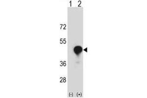 Western blot analysis of CD1c antibody and 293 cell lysate (2 ug/lane) either nontransfected (Lane 1) or transiently transfected (2) with the CD1C gene. (CD1c 抗体  (AA 226-253))