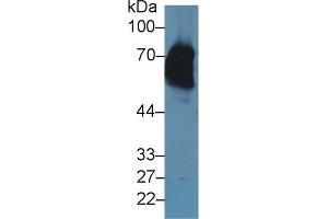 Western Blotting (WB) image for anti-Keratin 2 (KRT2) (AA 508-685) antibody (ABIN7437011)