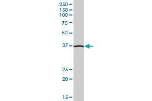 ADA MaxPab polyclonal antibody. (ADA 抗体  (AA 1-363))