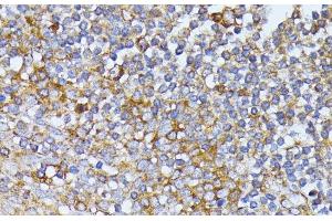 Immunohistochemistry of paraffin-embedded Human tonsil using EIF2B2 Polyclonal Antibody at dilution of 1:100 (40x lens). (EIF2B2 抗体)