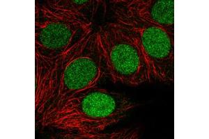 Immunofluorescent staining of MCF7 cells with PARP1 monoclonal antibody, clone CL2220  (Green) shows clear cycle dependent nuclear. (PARP1 抗体)