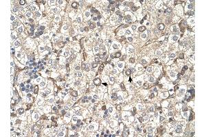 ST3GAL4 antibody was used for immunohistochemistry at a concentration of 4-8 ug/ml to stain Hepatocytes (arrows) in Human Liver. (ST3GAL4 抗体  (Middle Region))