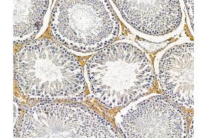 anti-Schlafen Family Member 13 (SLFN13) antibody
