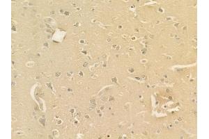 ABIN6262417 and ABIN6277679 at 1/100 staining human glioblastoma by IHC-P. (Serotonin Receptor 3A 抗体  (Internal Region))