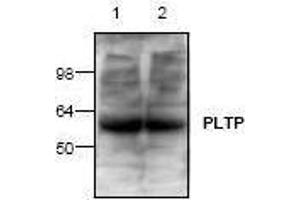 Image no. 1 for anti-Phospholipid Transfer Protein (PLTP) antibody (ABIN127227) (PLTP 抗体)