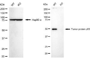 Western blotting analysis using tumor protein p53 antibody (ABIN7800687).