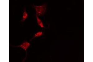 ABIN6275623 staining  HepG2 cells by IF/ICC. (CCT5 抗体  (Internal Region))