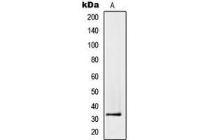 Western blot analysis of PMEPA1 expression in PC3 (A) whole cell lysates. (PMEPA1 抗体  (Center))