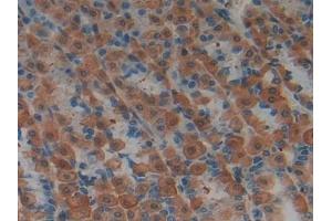 Detection of LIFR in Rat Stomach Tissue using Polyclonal Antibody to Leukemia Inhibitory Factor Receptor (LIFR) (LIFR 抗体  (AA 152-291))