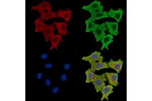 ABIN7096107 and ABIN7100169 staining HepG2 cells by IF/ICC. (EPS8-Like 1 抗体)