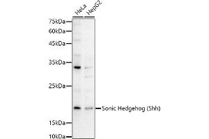 Western blot analysis of extracts of various cell lines, using Sonic Hedgehog (Shh) antibody (ABIN6134067, ABIN6147741, ABIN6147743 and ABIN6223662) at 1:1000 dilution. (Sonic Hedgehog 抗体)