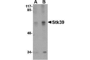 Western Blotting (WB) image for anti-serine threonine Kinase 39 (STK39) (C-Term) antibody (ABIN1030708) (STK39 抗体  (C-Term))
