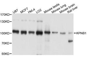Western blot analysis of extracts of various cell lines, using KPNB1 antibody. (KPNB1 抗体  (AA 250-350))