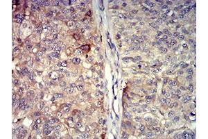 Immunohistochemistry (IHC) image for anti-Tumor Necrosis Factor (Ligand) Superfamily, Member 11 (TNFSF11) (AA 74-308) antibody (ABIN5611143)