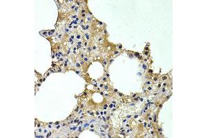 Immunohistochemistry of paraffin-embedded rat lung using HDC antibody at dilution of 1:200 (400x lens). (HDC 抗体)
