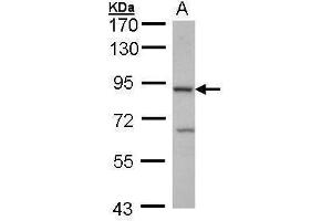 WB Image Sample (30 ug of whole cell lysate) A: Hep G2 , 7. (Cbl Proto-Oncogene B, E3 Ubiquitin Protein Ligase (CBLB) (C-Term) 抗体)