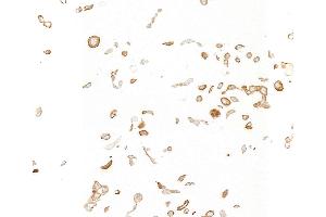 Immunocytochemistry (ICC) image for anti-Insulin-Like Growth Factor 1 Receptor (IGF1R) antibody (ABIN7795596) (IGF1R 抗体)