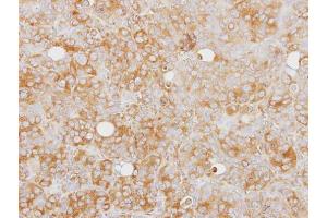 IHC-P Image Immunohistochemical analysis of paraffin-embedded SW480 xenograft, using Caspase 1 alpha, antibody at 1:100 dilution. (Caspase 1 抗体)