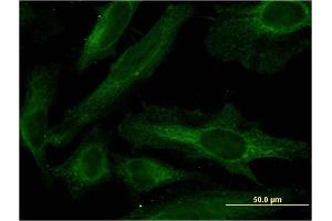 Immunofluorescence of monoclonal antibody to PDE4C on HeLa cell. (PDE4C 抗体  (AA 1-99))