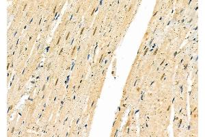 ABIN6261695 and ABIN6277334 at 1/100 staining Rat heart tissue by IHC-P. (FBXO32 抗体  (N-Term))