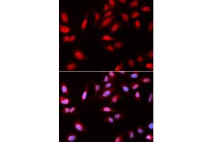 Immunofluorescence (IF) image for anti-3-phosphoinositide Dependent Protein Kinase-1 (PDPK1) (AA 150-429) antibody (ABIN3022352)
