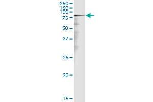 Immunoprecipitation of CALD1 transfected lysate using anti-CALD1 MaxPab rabbit polyclonal antibody and Protein A Magnetic Bead , and immunoblotted with CALD1 purified MaxPab mouse polyclonal antibody (B01P) . (Caldesmon 抗体  (AA 1-538))
