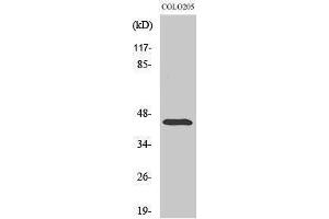 Western Blotting (WB) image for anti-Abhydrolase Domain Containing 12 (ABHD12) (Internal Region) antibody (ABIN3173622) (ABHD12 抗体  (Internal Region))