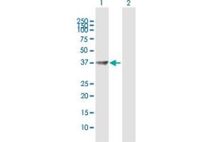 Western Blot analysis of PPP1R3C expression in transfected 293T cell line by PPP1R3C MaxPab polyclonal antibody. (PPP1R3C 抗体  (AA 1-317))